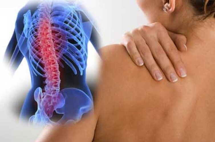 Osteokondroz ile ağrı vücudun uzak bölgelerine yayılabilir. 
