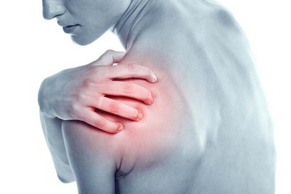 Omuzda ağrıyan ağrı, omuz ekleminin artrozunun bir belirtisidir
