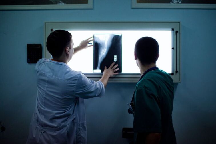 X -Ray'de artroz tanısı
