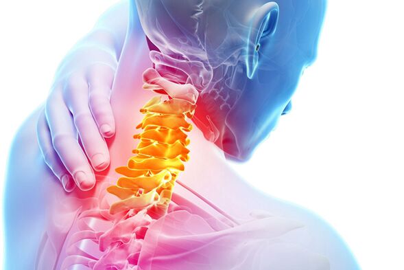 Servikal osteokondroz