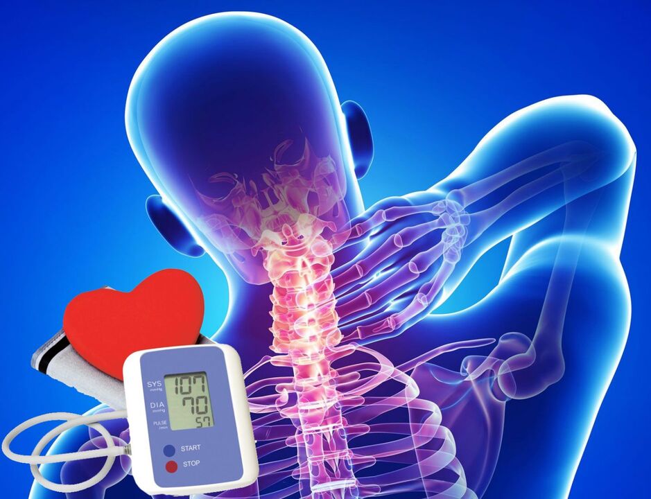 Servikal osteokondroz ile kan basıncında sıçramalar